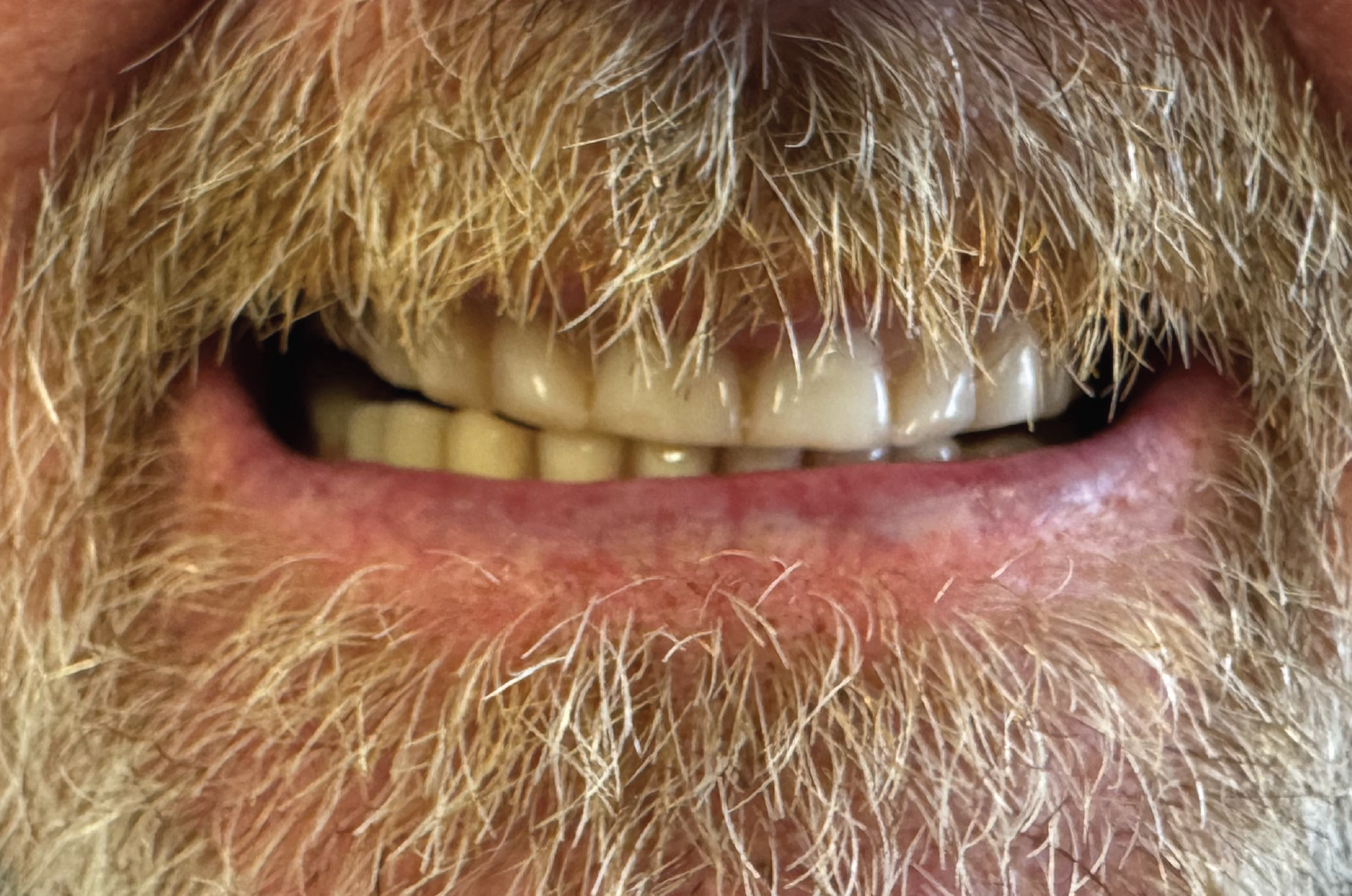 Echo Dental Solutions - Before