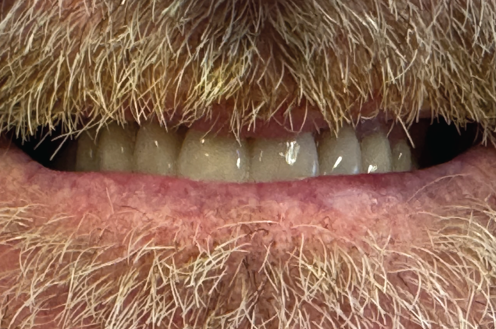 Echo Dental Solutions - After