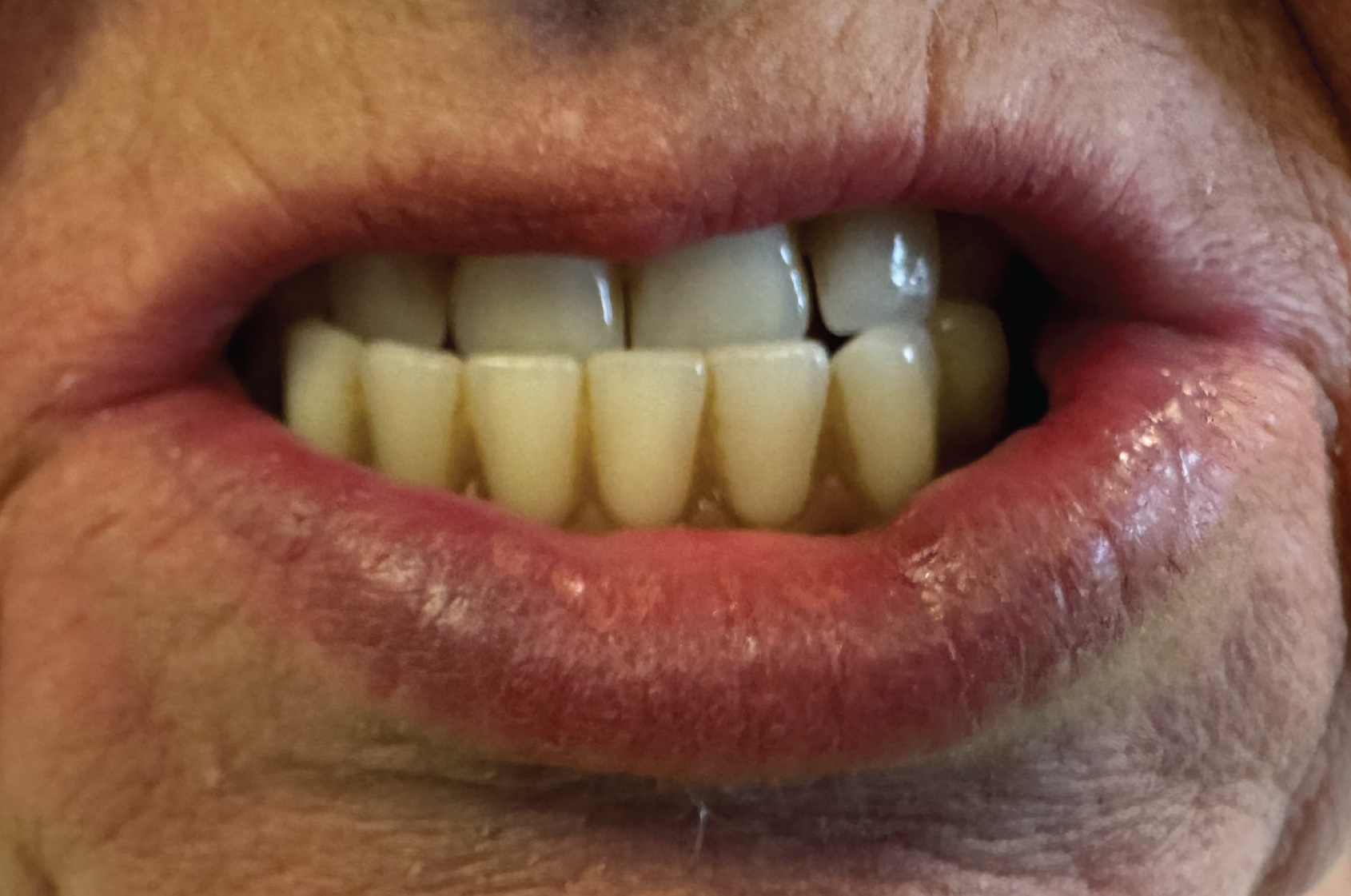 Echo Dental Solutions - Before