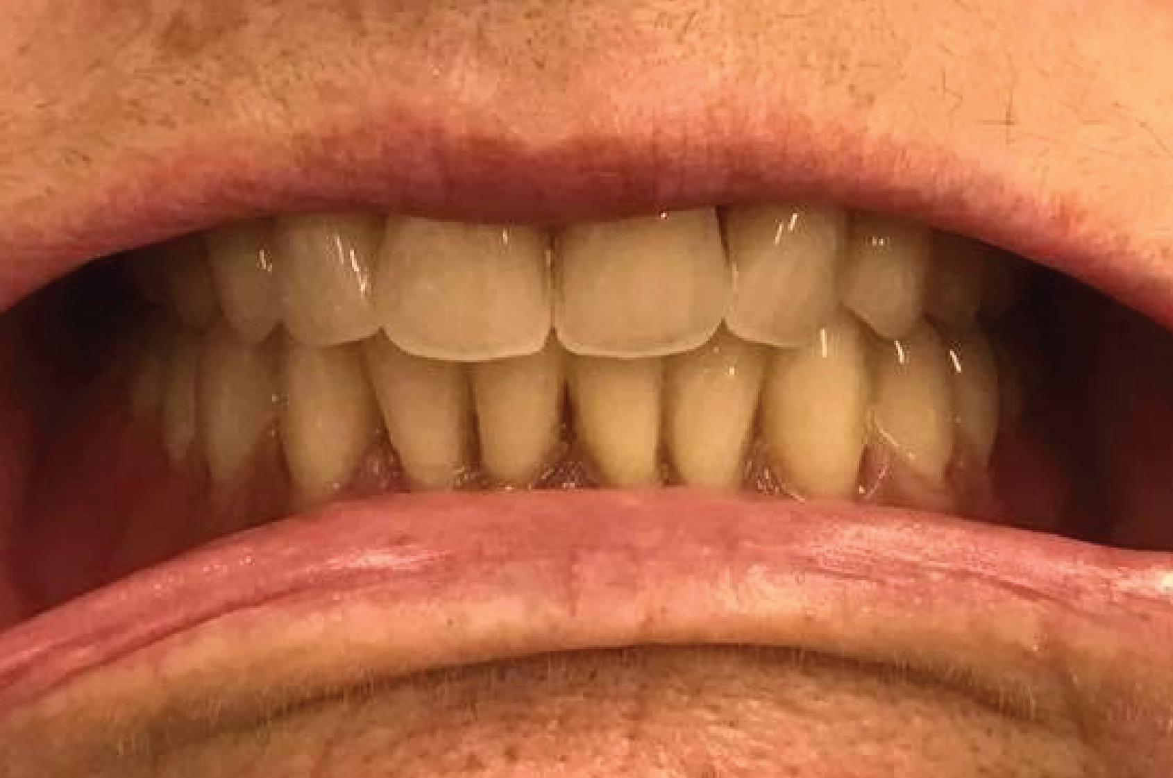 Echo Dental Solutions - Before