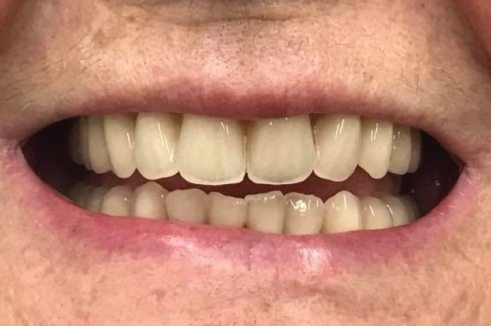 Echo Dental Solutions - Before